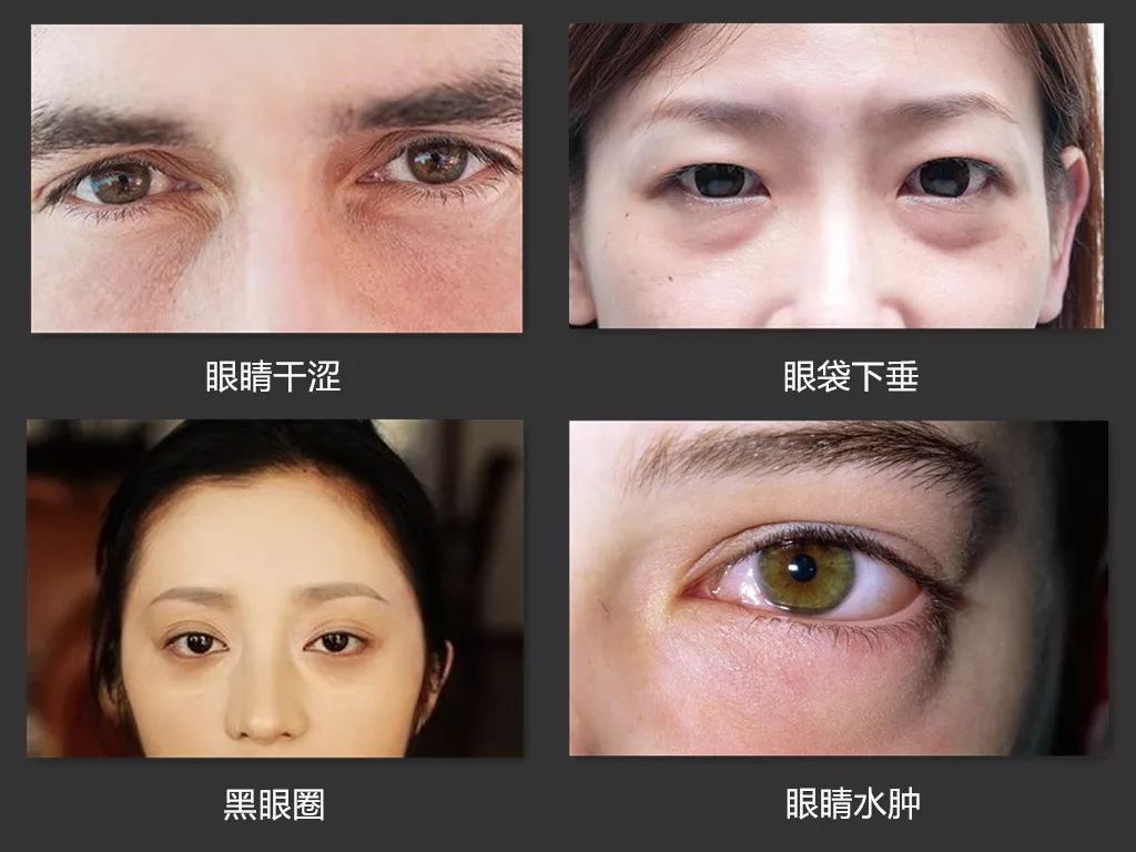消除眼袋，緩解眼疲勞，黑科技眼罩讓你秒入夢鄉，精神煥發