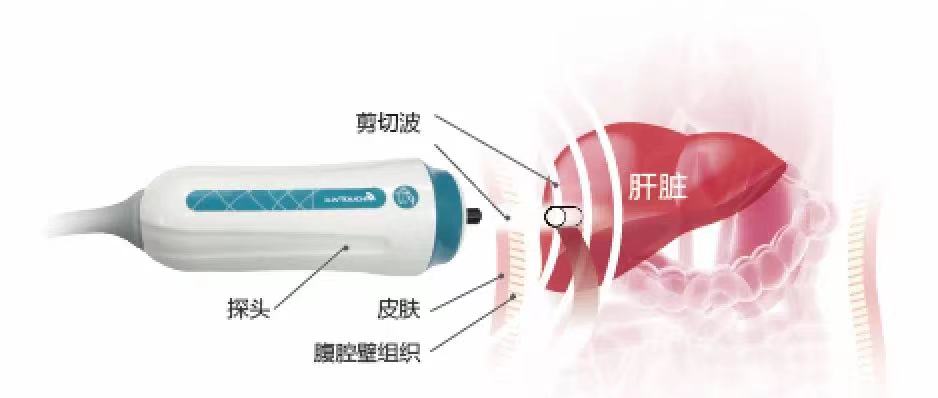 2021全國雙創周開幕！與總理連線對話，海斯凱爾靠什么讓總理點贊？