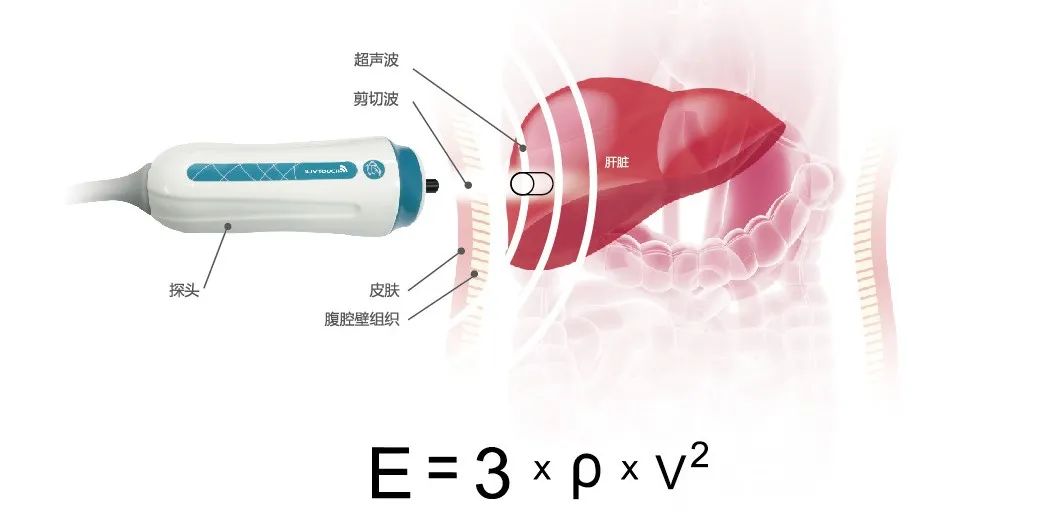 海斯凱爾榮獲“黃家駟工程生物醫學獎”技術發明類獎項！無創肝纖維化診斷技術深受認可